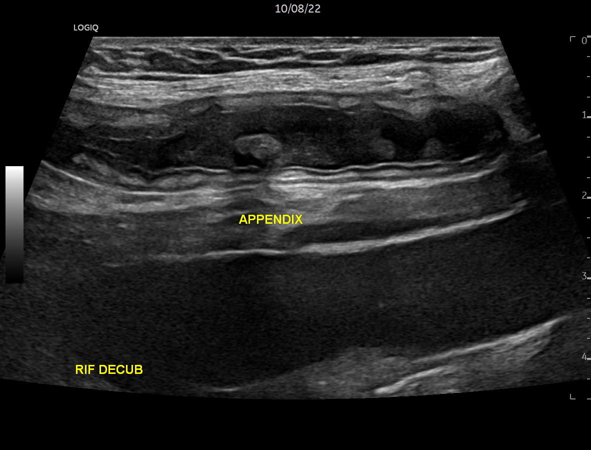 Basics Techniques Needed To Evaluate The Appendix Integrated 